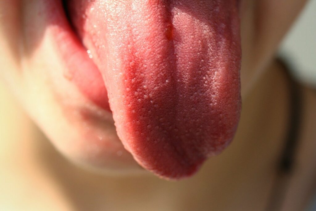 tongue health